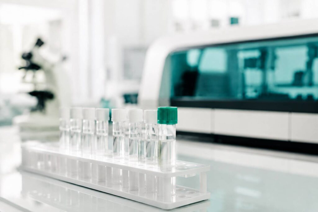 Tubes à essai de laboratoire avec un tube à bouchon vert pour un bilan sanguin
